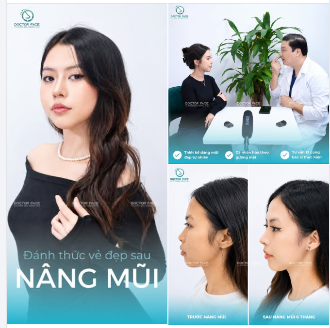 Một dáng mũi đẹp không có nghĩa là phải thật cao hay thật khác biệt.