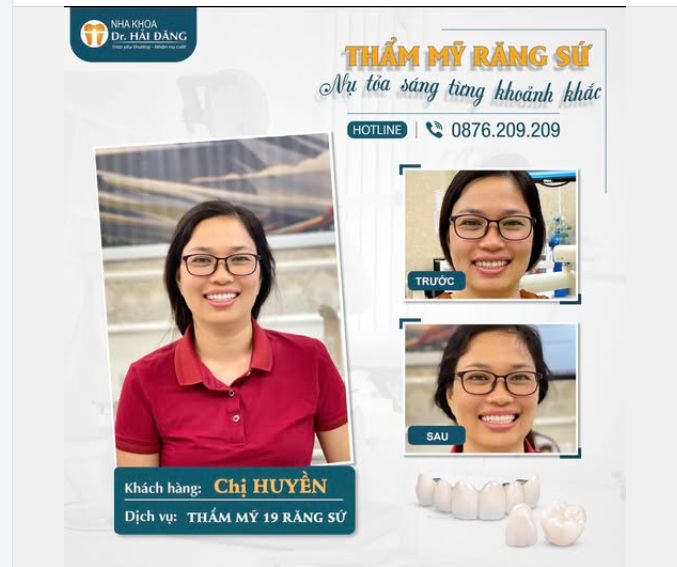 NỤ CƯỜI ĐẸP – TỰ TIN THAY ĐỔI CẢ DIỆN MẠO