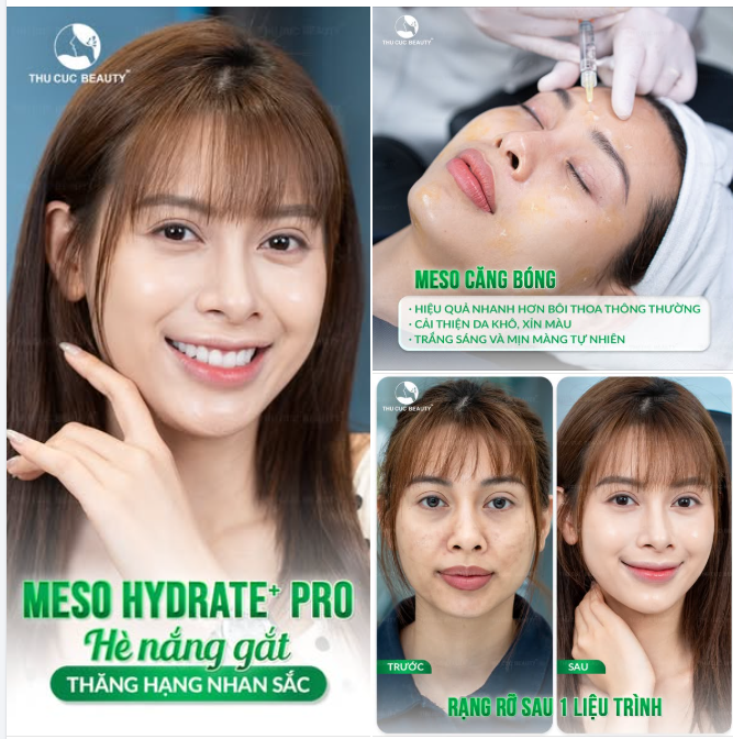 DA MƯỚT MỊN, BẬT TONE – RẠNG RỠ SAU 1 LIỆU TRÌNH MESO HYDRATE+ PRO!