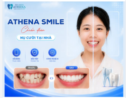 NẾU RĂNG ĐỀU ĐẶN VÀ ĐẸP HƠN, BẠN TRÔNG SẼ THẾ NÀO? XEM TRƯỚC NỤ CƯỜI TƯƠNG LAI CHỈ TRONG 30 GIÂY!