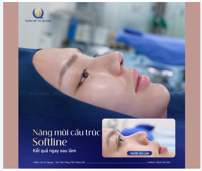 MŨI ĐẸP NGAY SAU SAU 60 PHÚT – KHÔNG LO ĐAU, SƯNG, BẦM!