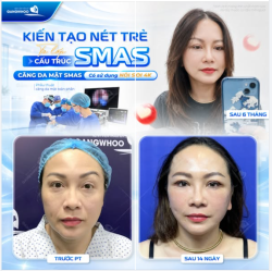 KIẾN TẠO NÉT TRẺ TỪ LỚP CẤU TRÚC SMAS