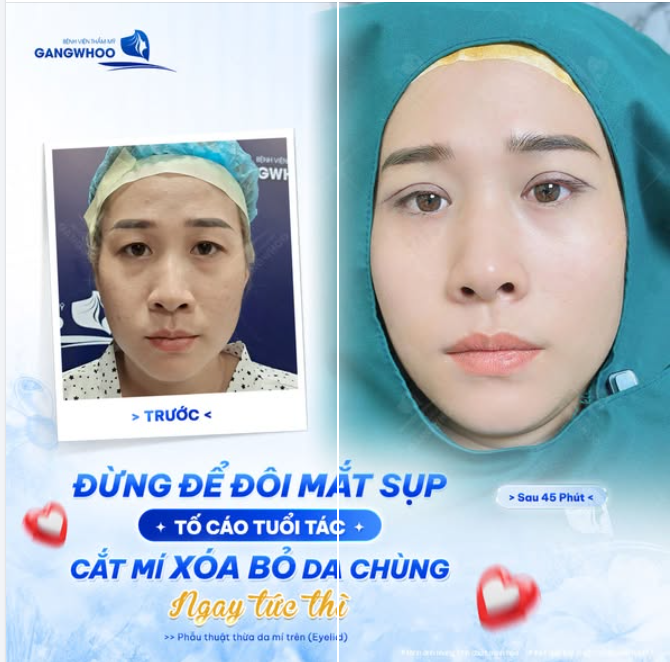 ĐỪNG ĐỂ ĐÔI MẮT TỐ CÁO TUỔI TÁC CỦA BẠN