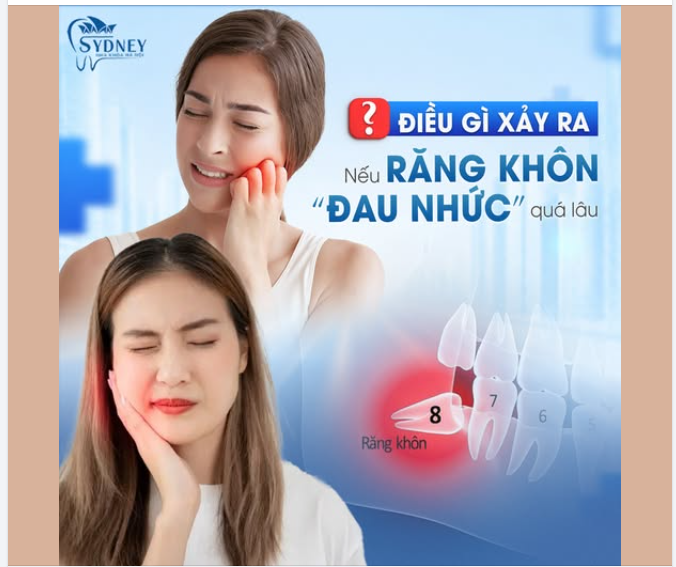 ĐIỀU GÌ XẢY RA NẾU RĂNG KHÔN ĐAU NHỨC QUÁ LÂU
