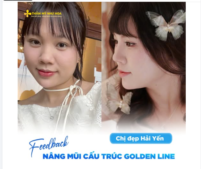 Đã bao lần bạn nhìn vào ảnh của các chị đẹp và nghĩ: