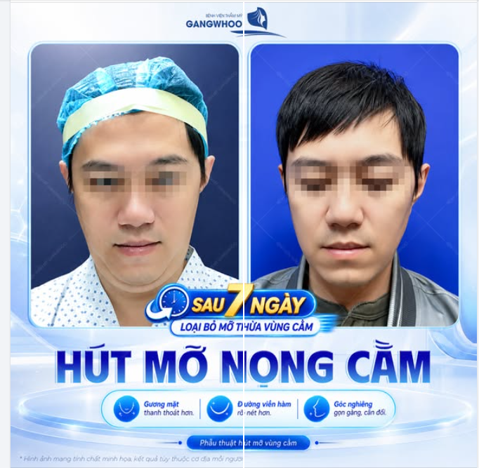 ĐƯỜNG VIỀN HÀM RÕ NÉT HƠN CHO NAM GIỚI