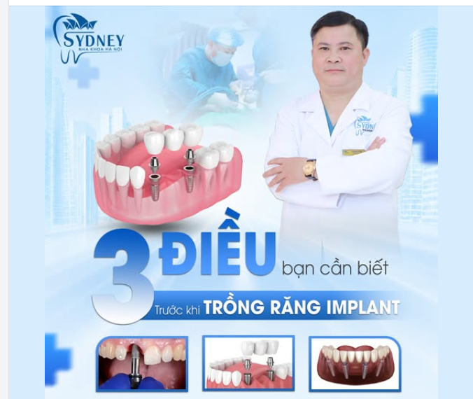 3 ĐIỀU BẠN CẦN BIẾT TRƯỚC KHI CẤY IMPLANT