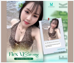 FLEX V1 CỰC CĂNG SAU 8 THÁNG NÂNG CẤP TẠI DR. MINH PHẠM