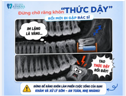ĐỪNG ĐỢI ĐẾN LÚC ĐAU MỚI ĐI NHỔ RĂNG KHÔN!