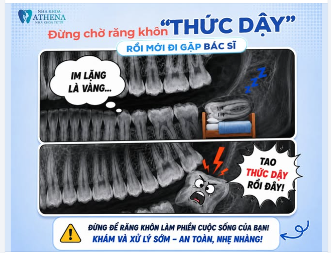ĐỪNG ĐỢI ĐẾN LÚC ĐAU MỚI ĐI NHỔ RĂNG KHÔN!