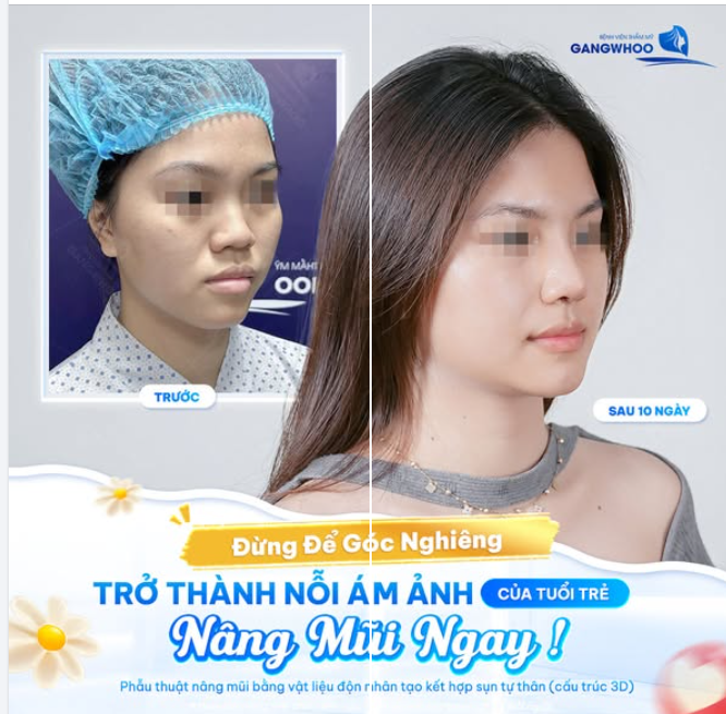 ĐỪNG ĐỂ GÓC NGHIÊNG TRỞ THÀNH NỔI ÁM ẢNH CỦA TUỔI TRẺ