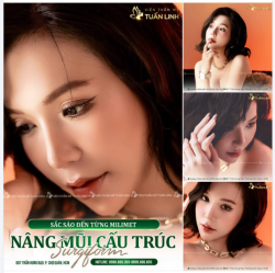 NÂNG MŨI CẤU TRÚC SURGIFORM - SẮC SẢO ĐẾN TỪNG MILIMET