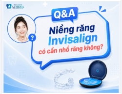 NIỀNG RĂNG TRONG SUỐT CÓ BẮT BUỘC PHẢI NHỔ RĂNG KHÔNG?