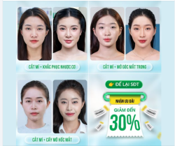 TRẢI NGHIỆM CẮT MÍ AN TOÀN TẠI THU CÚC Giảm đến 30%