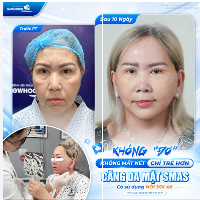 KHÔNG “ĐƠ” – KHÔNG MẤT NÉT, CHỈ TRẺ HƠN