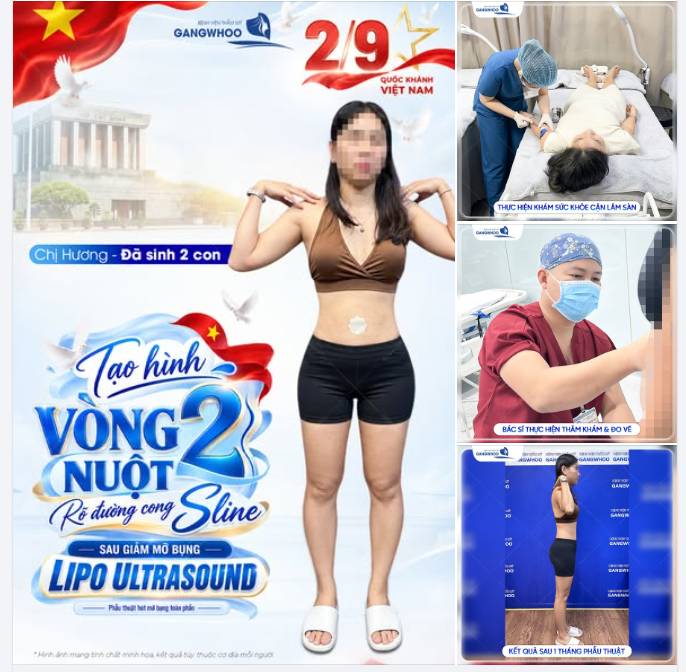 TẠO HÌNH VÒNG EO NUỘT, RÕ ĐƯỜNG CONG S LINE
