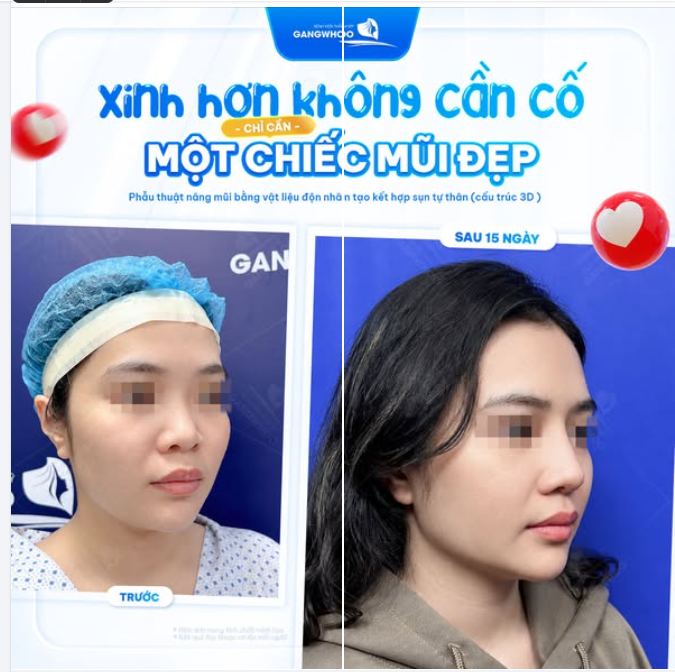 XINH HƠN KHÔNG CẦN CỐ