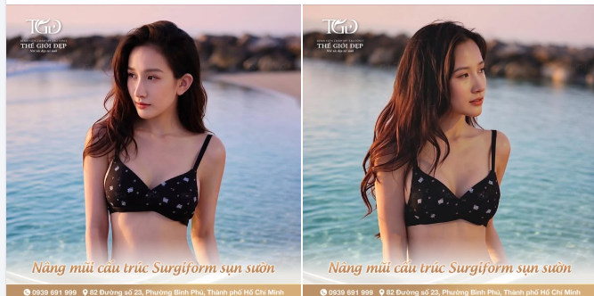 Chạm đến phiên bản hoàn hảo của chính mình nhờ dáng mũi phù hợp