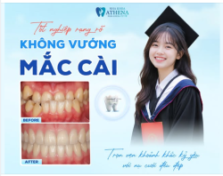 TỰ TIN TỎA SÁNG NGÀY TỐT NGHIỆP – HÀNH TRÌNH "LỘT XÁC" NỤ CƯỜI CỦA CÔ SINH VIÊN TRUYỀN THÔNG!
