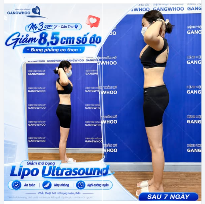 BỤNG PHẲNG EO THON CỦA MẸ 3 CON
