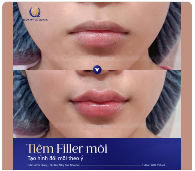 15 PHÚT BIẾN HÓA: TỪ MÔI MỎNG THIẾU NẾT THÀNH CĂNG MỌNG QUYẾN RŨ