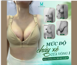 MỨC ĐỘ CHẢY XỆ VÒNG 1 – BẠN ĐANG Ở CẤP ĐỘ NÀO?