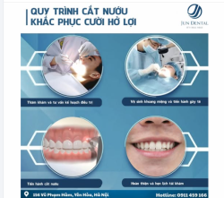 Bạn đang tự ti vì nụ cười hở lợi? Đừng lo, cắt nướu thẩm mỹ là giải pháp giúp cải thiện nhanh chóng, mang lại nụ cười cân đối và tự nhiên hơn