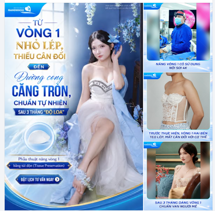 TỪ VÒNG 1 NHỎ LÉP, THIẾU CÂN ĐỐI - ĐẾN ĐƯỜNG CONG CĂNG TRÒN, CHUẨN TỰ NHIÊN SAU 3 THÁNG “ĐỘ LOA”