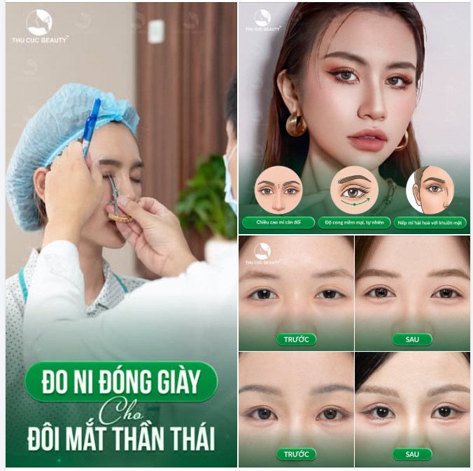 ĐẸP THEO TREND HAY ĐẸP THEO TỶ LỆ VÀNG?