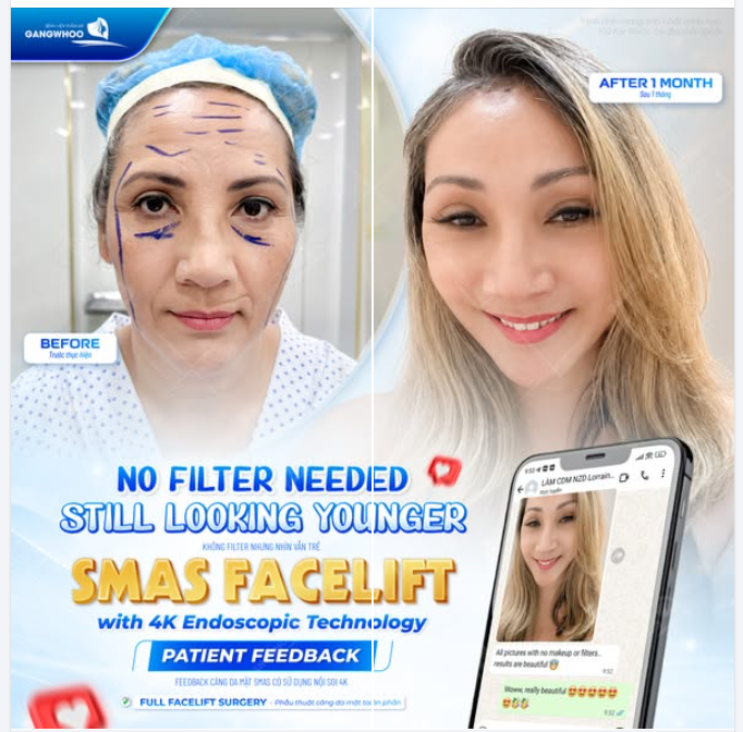 FEEDBACK "KHÔNG FILTER NHƯNG NHÌN VẪN TRẺ"