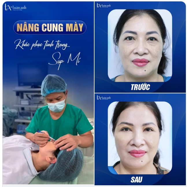 Bí quyết giữ gìn nét xuân đôi khi chỉ nằm ở một thay đổi nhỏ nhưng tinh tế. Cảm ơn chị đã tin chọn và đồng hành cùng Thẩm mỹ Tuấn Anh!