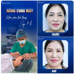Bí quyết giữ gìn nét xuân đôi khi chỉ nằm ở một thay đổi nhỏ nhưng tinh tế. Cảm ơn chị đã tin chọn và đồng hành cùng Thẩm mỹ Tuấn Anh!