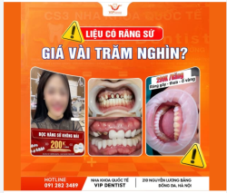 LIỆU CÓ RĂNG SỨ CHÍNH HÃNG "GIÁ VÀI TRĂM NGHÌN"? — CẢNH BÁO BẪY RĂNG SỨ GIÁ RẺ KÉM CHẤT LƯỢNG!