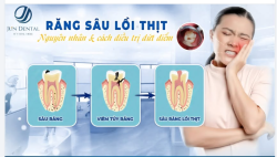 RĂNG SÂU LỖI THỊT – ĐỪNG ĐỂ ĐAU MỚI ĐIỀU TRỊ!