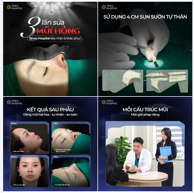 3 LẦN SỬA MŨI HỎNG - TIMES HOSPITAL TIẾP NHẬN VÀ KHẮC PHỤC