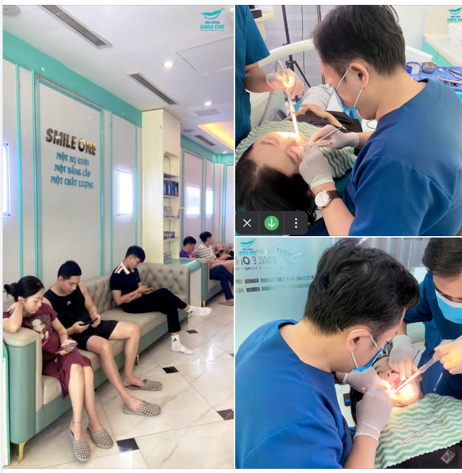 CUỐI TUẦN “HẾT CÔNG SUẤT” VỚI 3 CA NHỔ RĂNG LIÊN TIẾP TẠI SMILE ONE