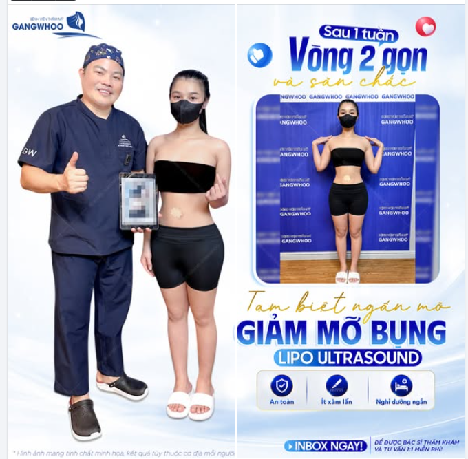 TẠM BIỆT NGẤN MỠ TỰ TIN KHOE DÁNG