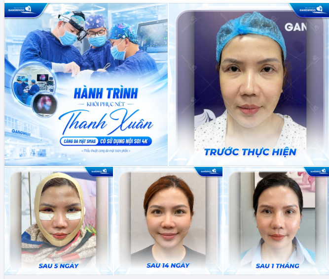 HÀNH TRÌNH KHÔI PHỤC NÉT THANH XUÂN