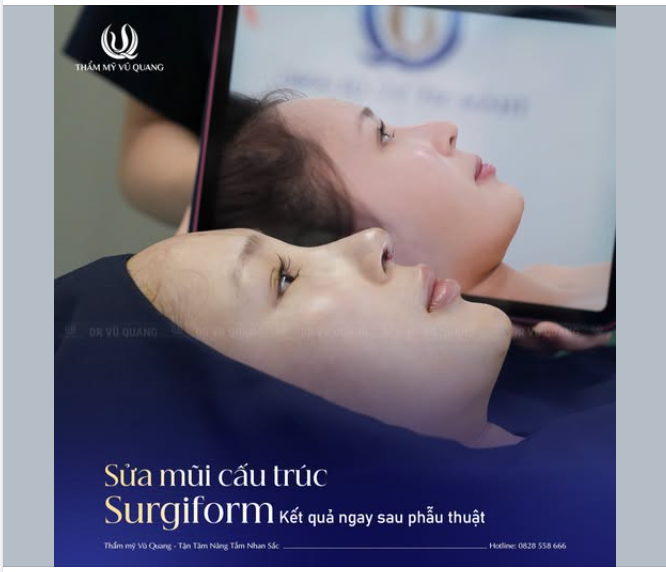 Vượt hàng trăm cây số, bạn gái từ Cần Thơ đã đặt trọn niềm tin vào Bác sĩ Vũ Quang để khắc phục tình trạng mũi hỏng nặng: Lộ sống, đầu mũi quá nhọn, gương mặt kém cân đối.
