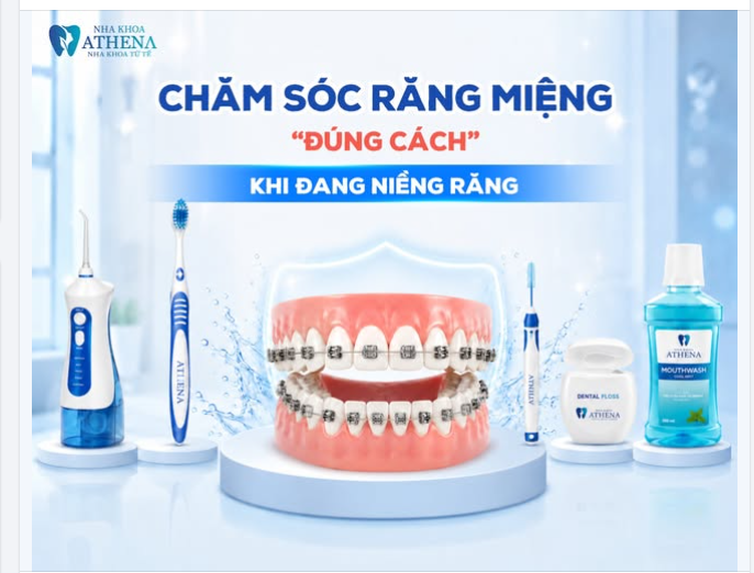CHĂM SÓC RĂNG MIỆNG ĐÚNG CÁCH KHI ĐANG NIỀNG