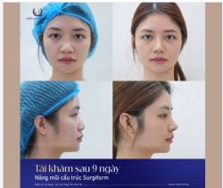 Khách hàng H.A khiến ai cũng bất ngờ với sự thay đổi ngoạn mục!