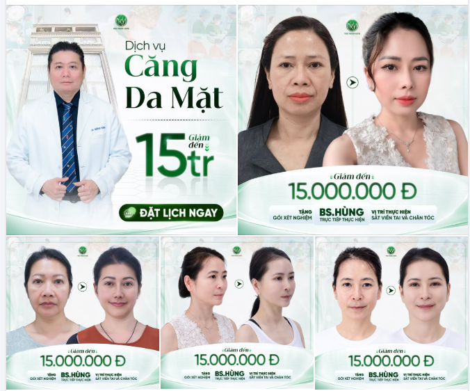 Điều gì khiến gương mặt thay đổi rõ đến vậy?