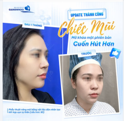 UPDATE THÀNH CÔNG CHIẾC MŨI MỚI