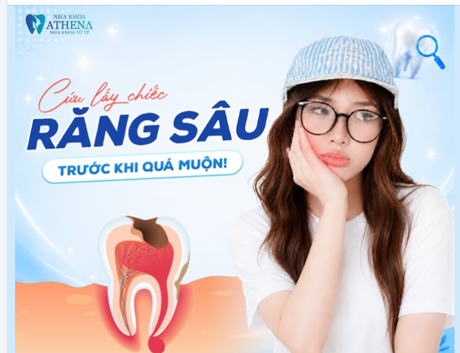 CỨU LẤY CHIẾC RĂNG SÂU TRƯỚC KHI QUÁ MUỘN!