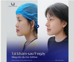 Mắt một mí, mũi cao tây: Combo cá tính đỉnh cao của cô nàng 2k4