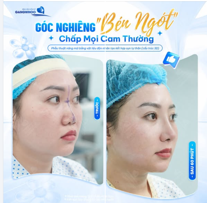 GÓC NGHIÊNG "BÉN NGÓT" CHẤP MỌI CAM THƯỜNG