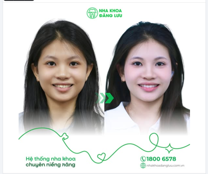 DẬY THÌ THÀNH... XINH ​​​​​​​  ...vì nụ cười đã theo kịp sự tự tin!