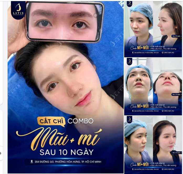 COMBO MŨI – MÍ 10 NGÀY: