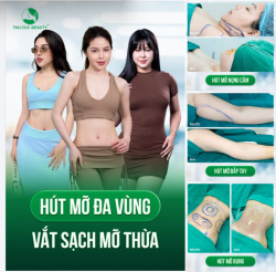 Mỡ bụng, bắp tay hay nọng cằm là những vùng mỡ cục bộ "cứng đầu"