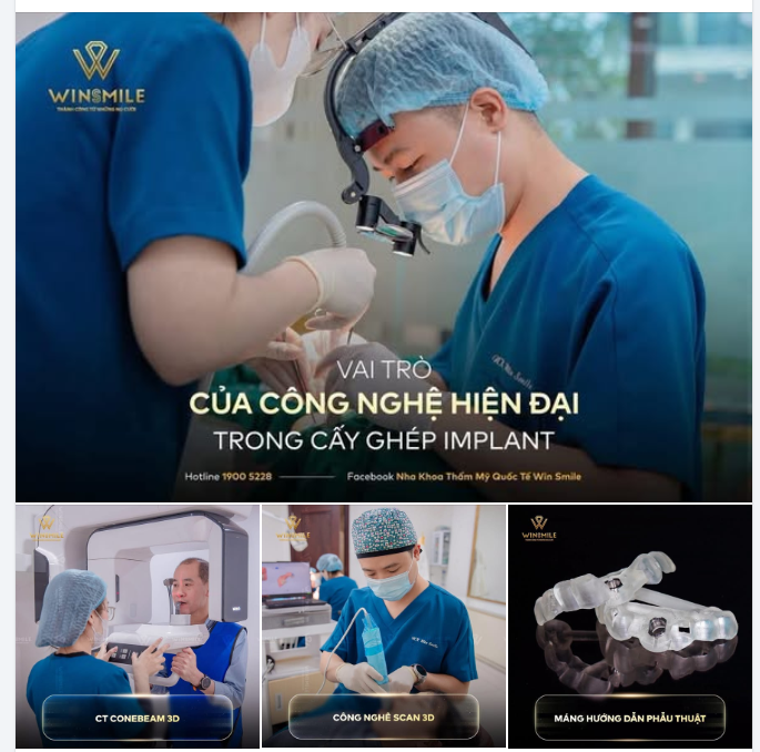 VAI TRÒ CỦA CÔNG NGHỆ HIỆN ĐẠI TRONG CẤY GHÉP IMPLANT